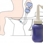 lave-anus
