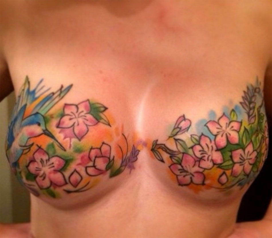 Cacher une cicatrice avec un tatouage